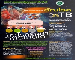 เฝ้าระวังและป้องกันการแพร่ระบาดวัณโรค